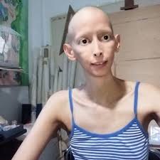 Fundraiser by Mirna Cellitti : Medical Expenses for Nereida Gonzalez Veraza