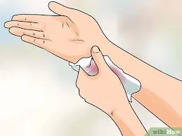 Wenn es sehr wehtut, scheint viel verletzt zu sein, dann geh zum arzt oder ins kh. Entscheiden Ob Eine Wunde Genaht Werden Muss 9 Schritte Mit Bildern Wikihow