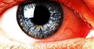 But what the poet didn't account for is that years of regular sun exposure can cast a shadow of their own, in the form 1. 12 Scary Things Your Eyes Say About Your Health Cbs News