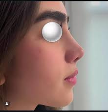 Bjorn Ironside's teeth and nose!