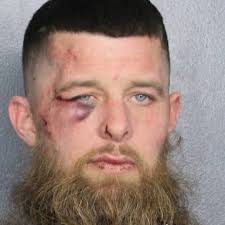 Allan Barry Date: 02/23/2025 Time: 12:00 AM Arresting Agency: HOLLYWOOD  Personal Information Arrest Age:40 Gender: Male Birthdate: 05/14/1984  Height: 5'11” Weight: 185 lbs Hair Color: Brown Eye Color: Blue Charges #1  BATTERY-CAUSE