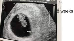 My First Prenatal Appointment 8 Weeks Pregnant Youtube