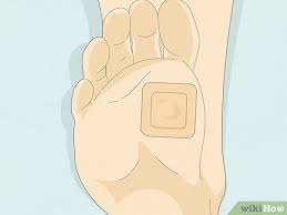 After 6 days or so, remove the duct tape and soak the verruca in some water. 7 Ways To Get Rid Of A Wart At The Bottom Of Your Foot Wikihow