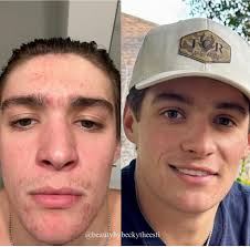 ♡SAN ANTONIO/ BOERNE AESTHETICIAN (@beautybybeckytheesti) · San Antonio, TX