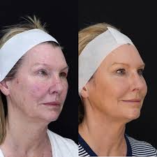 Ada West Dermatology