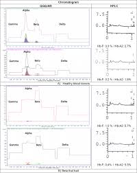 Check spelling or type a new query. Relative Proteome Quantification Of Alpha Beta Gamma And Delta Globin Chains In Early Eluting Peaks Of Bio Rad Variant Ii Ce Hplc Of Hemoglobin From Healthy And Beta Thalassemia Subjects In Malaysia Sciencedirect