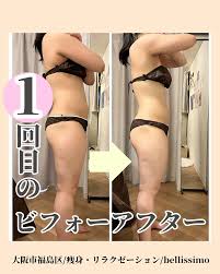 初めてでも安心！大阪の痩身エステ❤️‍🔥 | ブログ | 大阪市福島区のエステ、エステスクールならbellissimo