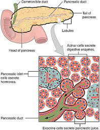 The most common form is the ductal adenocarcinoma, rarer types include squamous cell carcinoma, cystadenocarcinoma. Pancreatic Cancer Wikipedia