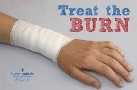Treating Burn Injuries From Fireworks
