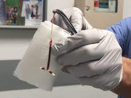 Prepare vaginal wall with betadine or hibiclens. What It S Like To Get An Iud