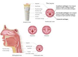 Image result for Vocal Cord Dysfunction