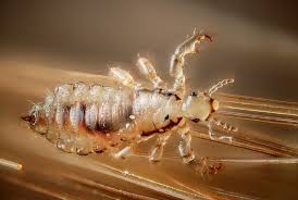 As they cannot apply harsh ingredients like vinegar on a daily basis to their hair and scalp. Split Ends Conditioners And Head Lice Wired