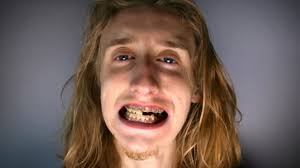 Patient who swallowed loose crown and told to recover it from her poo by  dental staff awarded £20,000