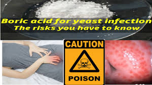 However, some of its behaviour towards some chemical reactions suggest it to be tribasic acid in the brønsted sense as well. Is Boric Acid Safe Can It Cure Yeast Infections Caution Boric Acid Poisoning D N Medical Series Youtube