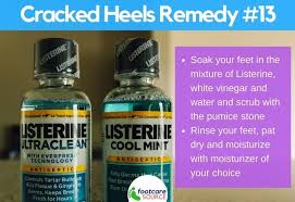 This homemade remedy is easy and cheap, and definitely worth trying out if you have cracked heels and fungal infected nails. 30 Amazing Home Remedies For Dry Cracked Feet The Fitness Tribe