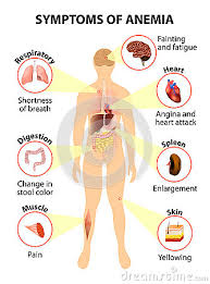 Lecture in internal medicine for iv anemia is a disease and/or a clinical syndrome that consist in lowered ability of the blood to carry. Symptoms Of Anemia