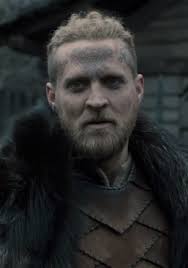 What Deformity Was Ivar'S 'Son' Born With In The Vikings (History Channel  Tv Series) Episode 'Baldur'? - Quora