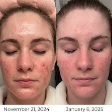 Julie Rose Grosso (@xfskincarebyjulie) • Instagram फोटोहरू र भिडियोहरू