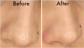 Orders placed on fri after 8pm, sat or sun will arrive by tuesday). How To Use Biore Pore Strips Charcoal