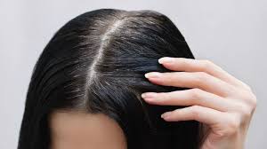 The research team, led by dr. Does Stress Really Cause Gray Hair