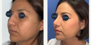 Jose Telich, MD, Plastic Surgeon