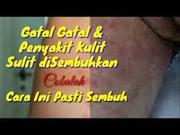 Serta saudara muslimin yg juga di rahmati allah, banyak sekali penyakit yg sulit d sembuhkan, allah swt memberikan ujian yg berupa penyakit, itu agar kita lebih ber takwa dan beriman pd allah ta'ala. Obat Gatal Gatal Dan Penyakit Kulit Paling Ampuh Sembuh Seketika Resep Herbal Alami Youtube Kulit Sistem Tubuh Manusia Obat Alami