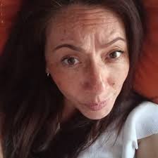 🟪TEL: 55 9190 4362 ⚠️ Para brindarte una mejor atención , sólo  personalmente por la Dra. Dublan, tendremos citas disponibles únicamente en  Atizapán de Zaragoza.