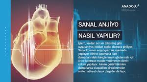 Sanal Anjiyo Her Hastaya Yapilabilir Mi Sanal Anjiyo Nedir Youtube