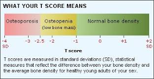 bone mineral density tests mydr com au