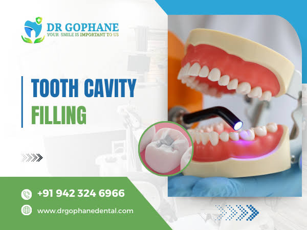 Tooth Cavity Filling In Yavatmal product image
