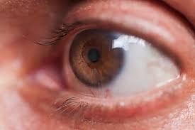 Can You Tell If You Have High Cholesterol By An Eye Exam