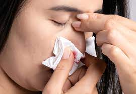 What Causes Nosebleeds While Sleeping Cleveland Clinic