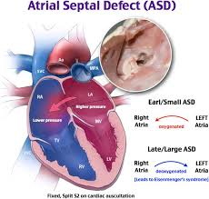 Rosh Review Pediatric Nursing Cardiac Nursing Pediatric Heart