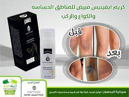 The following other wikis use this file: ÙƒØ±ÙŠÙ… Ø§ÙŠÙÙŠÙ†ÙŠØ³ ØªØ¨ÙŠÙŠØ¶ Ù„Ù„Ø³ÙˆØ§Ø¯ ØªØ­Øª Ø§Ù„Ø§Ø¨Ø·ÙŠÙ† ØµÙŠØ¯Ù„ÙŠØ© Ø§Ù„Ù…Ø¯Ù‡ÙˆÙ† ØªÙŠÙØ§ ÙØ§Ø±Ù… Facebook