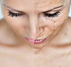 TGI Fall » Premier Dermatology