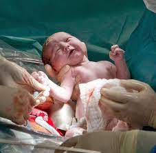 Würde gerne mein arzt fragen aber habe erst am 11.06 den termin. Vaginalsekret Hilft Diese Methode Dem Immunsystem Von Kaiserschnitt Babys Welt