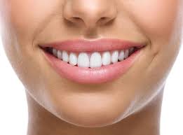 Teeth Aligners in Dubai | Dr Roze Biodental Clinic