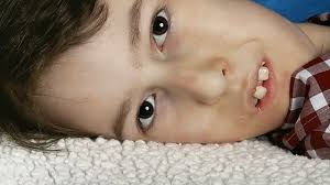 Slanted Perspectives: My LIfe with SMA short film reviews