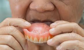 Image result for dentures