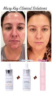 Testimonio Booster Niacinamida Mary Kay