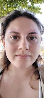 Reviews of Moxy Esthetics