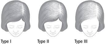 Hair loss in black women is incredibly common. Treating Female Pattern Hair Loss Harvard Health