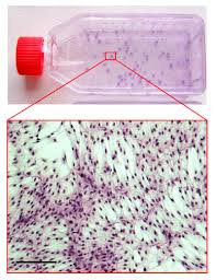 Mesenchymal Stromal Cell Culture And Delivery In Autologous Conditions A Smart Approach For Orthopedic Applications Protocol Translated To Turkish