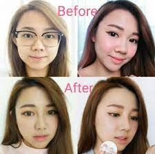 It combines the best of both affordability and quality, due to its low cost of living and modern infrastructure. Carmen A Famous Id Plastic Surgery Hospital Korea Facebook