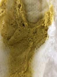 Image result for yellow stool human poop