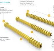 Cannulated Screw System | Acumed