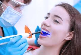 Dental Fillings Paso Robles