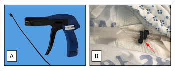 Also does the weapons change when the shop resets? Tube Thoracostomy During The Covid 19 Pandemic Guidance And Recommendations From The Aast Acute Care Surgery And Critical Care Committees Trauma Surgery Acute Care Open
