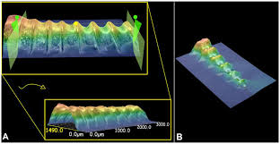 Primary Stability of Temporary Screws after Dentary and Orthopedic Forces  under Static and Dynamic Load Cycles