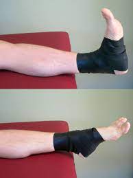 Pin On Posterior Tibial Tendonitis